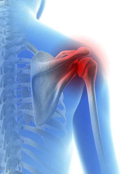 Baseball Shoulder Injuries